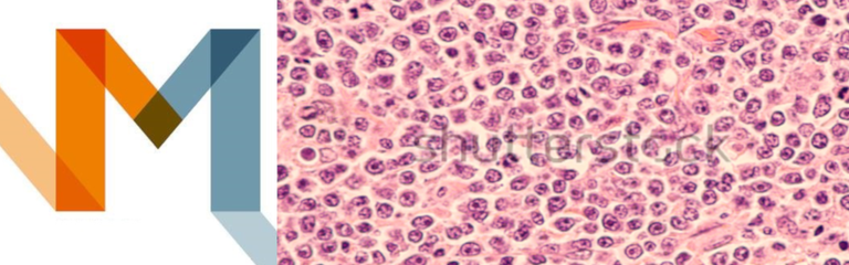 linfoma1.png